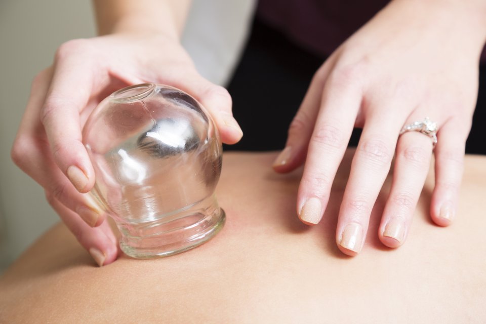 mão segurando uma ventosa sendo aplicada em corpo de uma outra pessoa